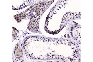 IHC analysis of SMC6L1 using anti-SMC6L1 antibody (ABIN5693133). (SMC6 抗体  (AA 205-443))