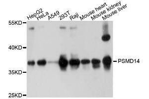 Western Blotting (WB) image for anti-Proteasome (Prosome, Macropain) 26S Subunit, Non-ATPase, 14 (PSMD14) (AA 160-300) antibody (ABIN6146340)