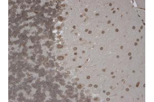 IHC analysis of TrpM7 tested on mouse brain using a dilution of TRPM7 antibody. (TRPM7 抗体  (AA 1817-1863))