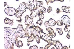 IHC analysis of HDAC5 using anti-HDAC5 antibody (ABIN6719321). (HDAC5 抗体  (AA 102-197))