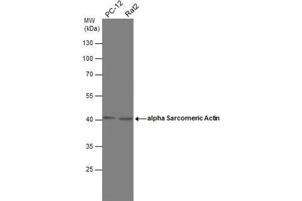 Actin, gamma 1 抗体  (N-Term)