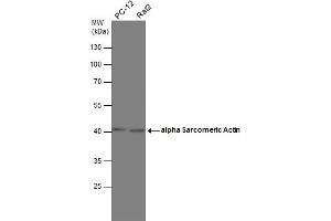 WB Image Various whole cell extracts (30 μg) were separated by 10% SDS-PAGE, and the membrane was blotted with alpha Sarcomeric Actin antibody , diluted at 1:1000. (Actin, gamma 1 抗体  (N-Term))