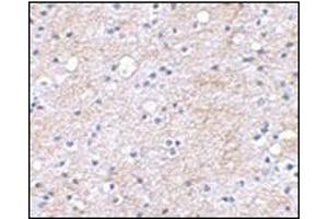 Immunohistochemical staining of human brain tissue using AP30496PU-N at 2. (LGI1 抗体  (Center))