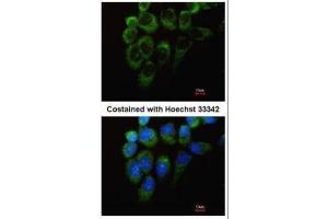 ICC/IF Image Immunofluorescence analysis of methanol-fixed A431, using Tyrosyl tRNA synthetase, antibody at 1:200 dilution. (YARS 抗体  (C-Term))