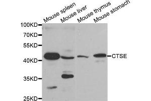 Western blot analysis of extracts of various tissues, using CTSE antibody. (Cathepsin E 抗体)