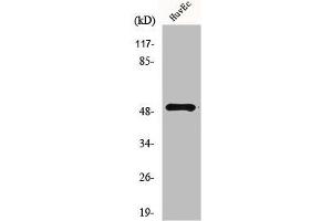 Western Blot analysis of HuvEc cells using Mnk1 Polyclonal Antibody (MKNK1 抗体  (Internal Region))