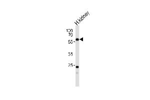 Western blot analysis of lysate from human kidney tissue lysate, using PFKFB3 Antibody  (ABIN392768 and ABIN2842213). (PFKFB3 抗体  (C-Term))