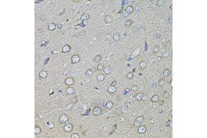 Immunohistochemistry of paraffin-embedded rat brain using SPP1 antibody (ABIN1874927) at dilution of 1:100 (40x lens). (Osteopontin 抗体)