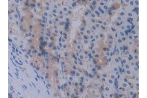 Immunohistochemistry (IHC) image for anti-Signal Transducing Adaptor Molecule (SH3 Domain and ITAM Motif) 1 (STAM) (AA 199-466) antibody (ABIN7443425)