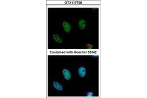 Image no. 1 for anti-Chromodomain Protein, Y-Like (CDYL) (AA 1-544) antibody (ABIN1497464) (CDYL 抗体  (AA 1-544))