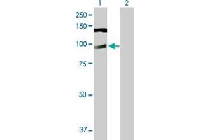 Western Blot analysis of CWC22 expression in transfected 293T cell line by CWC22 MaxPab polyclonal antibody. (CWC22 抗体  (AA 1-908))