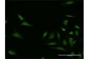 Immunofluorescence of monoclonal antibody to MKNK1 on HeLa cell. (MKNK1 抗体  (AA 1-100))