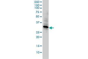 REC14 monoclonal antibody (M01), clone 3E5-1A12 Western Blot analysis of REC14 expression in Hela . (WDR61 抗体  (AA 1-305))