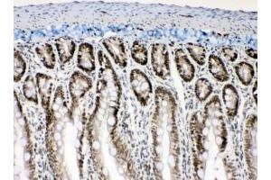 Immunohistochemistry (IHC) image for anti-Musashi Homolog 1 (Drosophila) (MSI1) (AA 21-54) antibody (ABIN5647867)