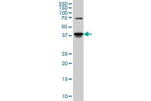 SGK2 monoclonal antibody (M04), clone 4B12 Western Blot analysis of SGK2 expression in PC-12 . (SGK2 抗体  (AA 293-367))