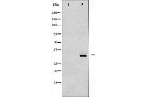 Western blot analysis of DARPP-32 phosphorylation expression in PMA treated NIH-3T3 whole cell lysates,The lane on the left is treated with the antigen-specific peptide. (DARPP32 抗体  (pThr34))