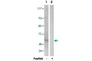Western blot analysis of extracts from HepG2 cells, using IL2RB polyclonal antibody . (IL2 Receptor beta 抗体)