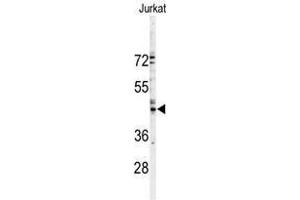Image no. 1 for anti-Gap Junction Protein, alpha 3, 46kDa (GJA3) (N-Term) antibody (ABIN357087) (GJA3 抗体  (N-Term))