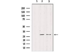 Western blot analysis of extracts from various samples, using RPS4Y1 Antibody. (RPS4Y1 抗体)