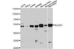 Western blot analysis of extracts of various cell lines, using SLC2A1 antibody. (GLUT1 抗体  (AA 210-310))