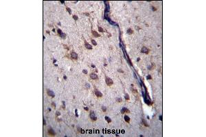 DYSFIP1 Antibody (N-term) (ABIN657090 and ABIN2846248) immunohistochemistry analysis in formalin fixed and paraffin embedded human brain tissue followed by peroxidase conjugation of the secondary antibody and DAB staining. (PPP1R27 抗体  (N-Term))