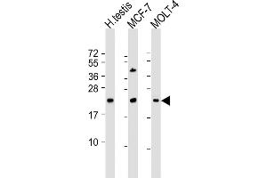 All lanes : Anti-STAG3L1 Antibody (Center) at 1:2000 dilution Lane 1: human testis lysate Lane 2: MCF-7 whole cell lysate Lane 3: MOLT-4 whole cell lysate Lysates/proteins at 20 μg per lane. (STAG3L1 抗体  (AA 108-136))