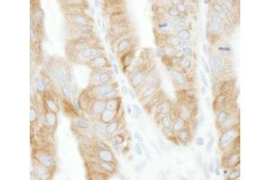 Immunohistochemistry (IHC) image for anti-TNF Receptor-Associated Factor 2 (TRAF2) (AA 300-350) antibody (ABIN7453559) (TRAF2 抗体  (AA 300-350))