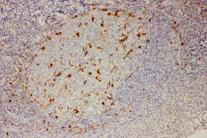 Anti-IL18 Picoband antibody,  IHC(P): Human Tonsil Tissue (IL-18 抗体  (AA 37-193))