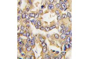Image no. 3 for anti-Visinin-Like 1 (VSNL1) (C-Term) antibody (ABIN357108) (VSNL1 抗体  (C-Term))