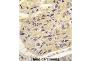 Immunohistochemistry (IHC) image for anti-Frequently Rearranged in Advanced T-Cell Lymphomas (FRAT1) antibody (ABIN2997937)