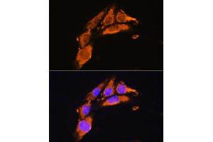 Immunofluorescence analysis of NIH/3T3 cells using AGRN Rabbit pAb (ABIN7265516) at dilution of 1:100. (AGRN 抗体  (AA 30-350))