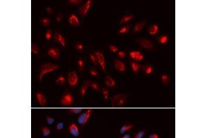 Immunofluorescence analysis of U2OS cells using CHRM5 Polyclonal Antibody (CHRM5 抗体)