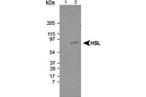 Western blot analysis of Lipe using Lipe polyclonal antibody . (LIPE 抗体  (AA 699-908))