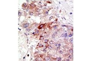 Image no. 2 for anti-Protein Inhibitor of Activated STAT, 1 (PIAS1) (N-Term) antibody (ABIN5552003) (PIAS1 抗体  (N-Term))