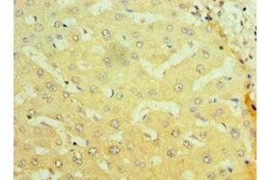 Immunohistochemistry of paraffin-embedded human liver tissue using ABIN7161897 at dilution of 1:100 (NR1I2 抗体  (AA 175-434))