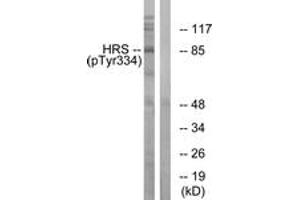Western blot analysis of extracts from HepG2 cells treated with PMA 125ng/ml 30', using HRS (Phospho-Tyr334) Antibody. (HRS (HRS) (AA 301-350), (pTyr334) 抗体)