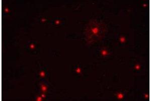 Immunostaining of primary rat oligodendrocytes using anti-Olig1. (OLIG1 抗体)