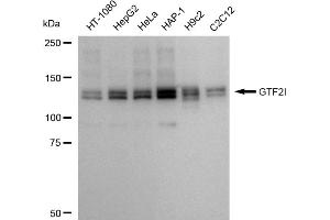 Western blotting analysis using GTF2I antibody (ABIN7798709). (Recombinant GTF2I 抗体)