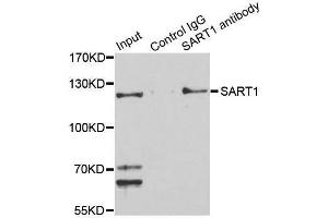 Immunoprecipitation analysis of 150 μg extracts of Jurkat cells using 3 μg SART1 antibody (ABIN5996293). (SART1 抗体)