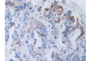 Immunohistochemistry (IHC) image for anti-Solute Carrier Family 12 (Sodium/Chloride Transporters), Member 3 (SLC12A3) (AA 3-146) antibody (ABIN7435784)