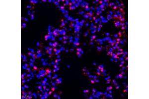 Immunofluorescence of paraffin embedded mouse lung using Transketolase (ABIN7075978) at dilution of 1: 1100 (400x lens) (TKT 抗体)
