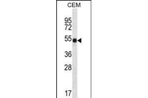 DAZ3 Antibody (C-term) (ABIN656239 and ABIN2845555) western blot analysis in CEM cell line lysates (35 μg/lane). (DAZ3 抗体  (C-Term))