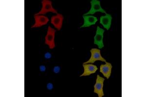 RPS6 Mouse Monoclonal Antibody staining Hela cells by IF/ICC.