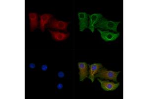 ABIN7094674 and ABIN7098725 staining Hela cells by IF/ICC. (CPEB4 抗体  (Internal Region))
