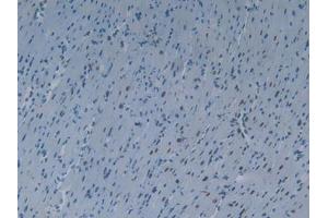 IHC-P analysis of Mouse Heart Tissue, with DAB staining. (KHDRBS1 抗体  (AA 156-381))