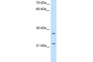 Western Blotting (WB) image for anti-Chromosome 21 Open Reading Frame 33 (C21orf33) antibody (ABIN2462904) (C21orf33 抗体)