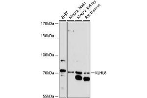 Western blot analysis of extracts of various cell lines, using KLHL8 antibody (ABIN7268081) at 1:1000 dilution. (KLHL8 抗体  (AA 271-620))