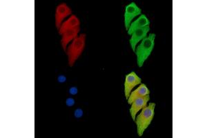 ABIN7097157 and ABIN7101225 staining Hela cells by IF/ICC. (MANBA 抗体)