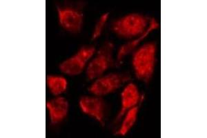 ABIN6267240 staining K562 by IF/ICC. (JAK2 抗体  (pTyr221))