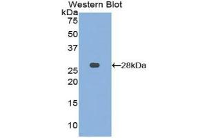 Western blot analysis of the recombinant protein. (MMP15 抗体  (AA 336-539))